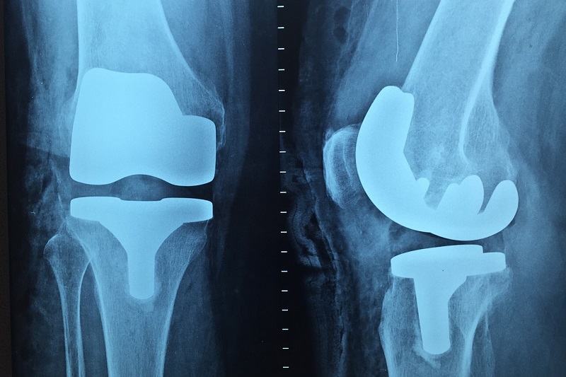 The state of orthopaedic surgery